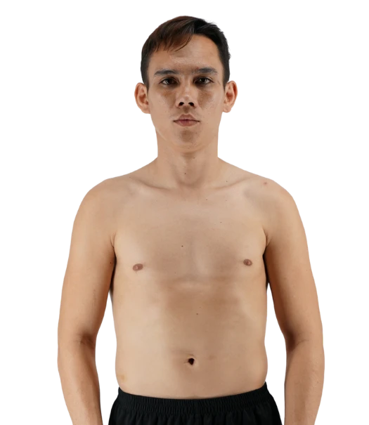 Dennapho